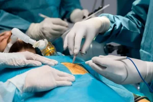 What to Expect During Modern Hernia Repair Surgery