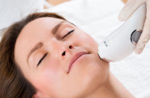 What is an IPL Laser and What are its Benefits?