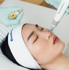 Unlock Radiant Skin: The Ultimate Guide to Using a Microneedling Pen