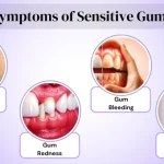 Why Do My Gums Suddenly Hurt? Signs & Solutions 2026