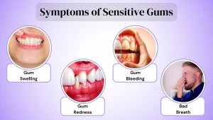 Why Do My Gums Suddenly Hurt? Signs & Solutions 2026