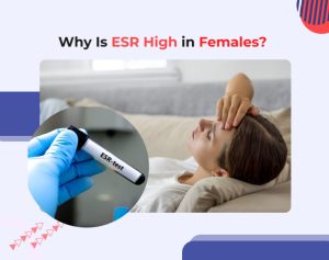 Why ESR Is High in Female? Causes Explained 2026