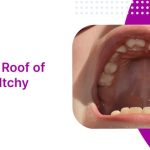 Why Is the Roof of My Mouth Itchy? Allergy or Infection 2026