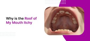 Why Is the Roof of My Mouth Itchy? Allergy or Infection 2026
