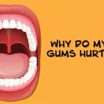 Why Does My Gum Hurt? Causes, Symptoms & Treatment 2026