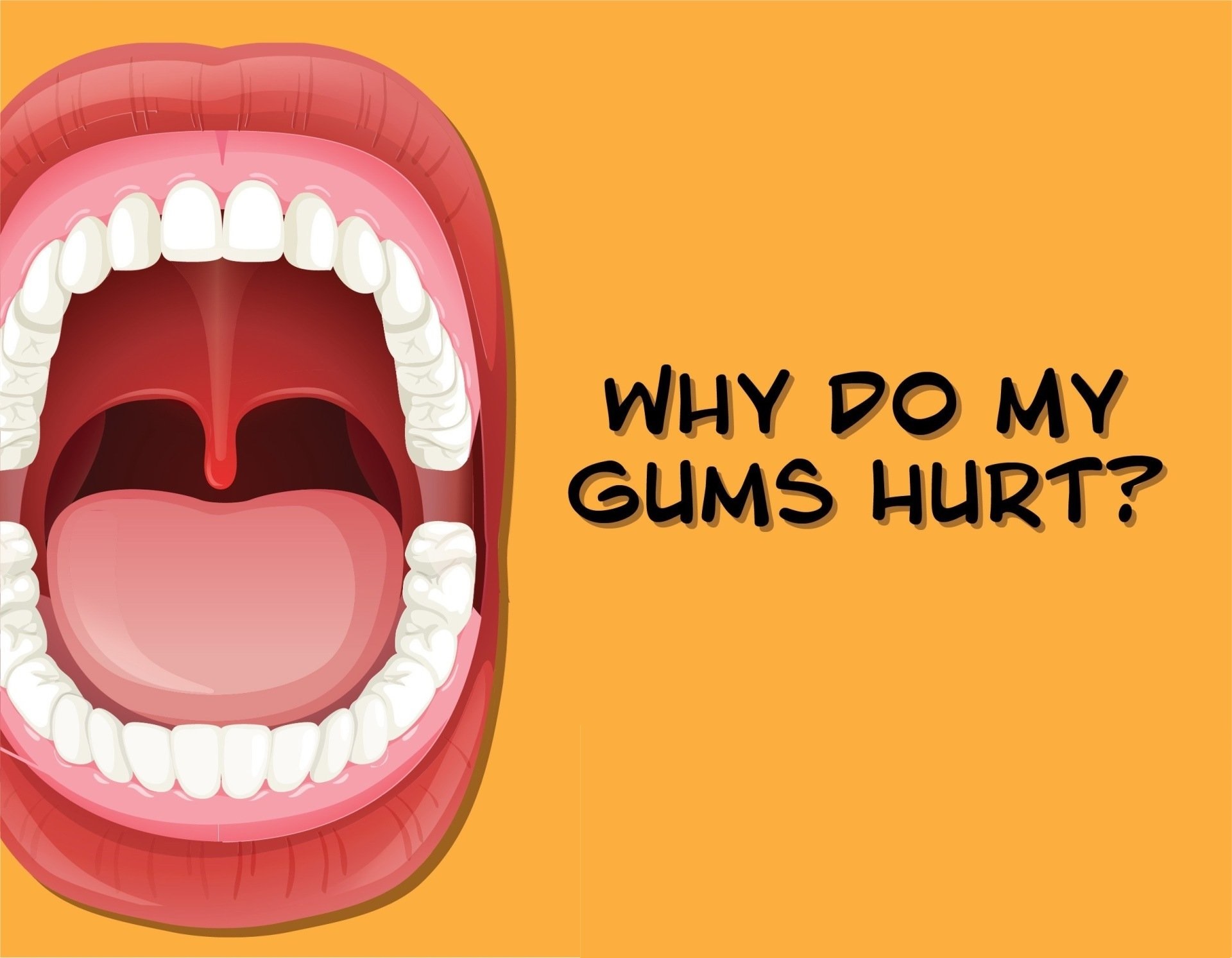 Why Does My Gum Hurt? Causes, Symptoms & Treatment 2026