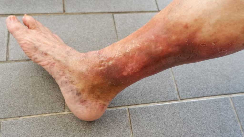 Why Do My Legs Feel Heavy? Here’s What It Means 2026