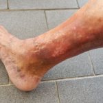 Why Do My Legs Feel Heavy? Here's What It Means 2026