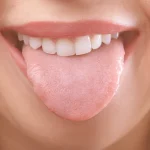 Why Does My Tongue Hurt on the Side? Top Reasons 2026