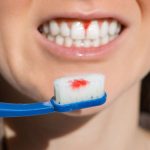 Why Do My Gums Bleed When I Brush My Teeth? Fixes 2026