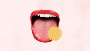Why Does My Tongue Hurt? Should You Worry? 2026
