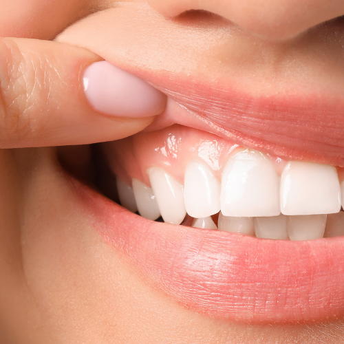 Why Is My Gum Swollen Around One Tooth in the Back Suddenly? 2026