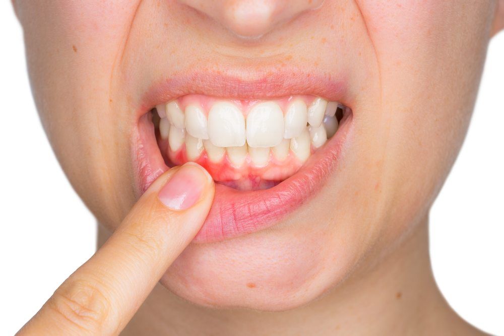 Why Is My Gum Swollen Around One Tooth in the Back Suddenly? 2026