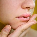 Why Is My Lip Swollen on One Side — When to Worry 2026