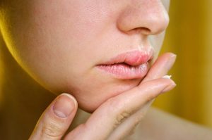 Why Is My Lip Swollen on One Side — When to Worry 2026