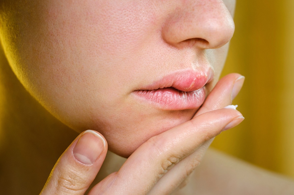 Why Is My Lip Swollen on One Side — When to Worry 2026