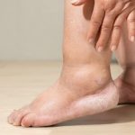 Why Do My Legs Feel Heavy and Weak? Causes & Fixes 2026