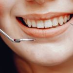 Why Does My Tooth Filling Hurt After Months? Common Reasons 2026