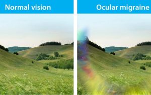 Why Am I Suddenly Getting Ocular Migraines? What to Know 2026