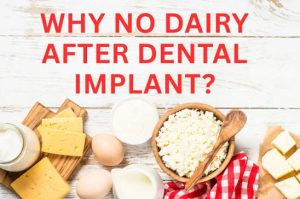 Why No Dairy After Dental Implant? Foods to Eat 2026