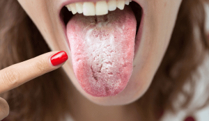 Why Is My Tongue White? Here’s What It Means 2026