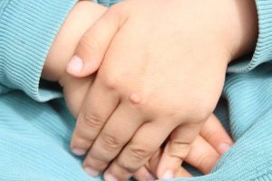 Why Do Kids Get Warts? Causes, Risks & Remedies 2026