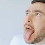 Why Does the Back of My Tongue Hurt? Possible Causes 2026