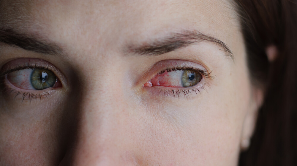 Why Is the Corner of My Eye Itchy? Causes and What to Do 2026