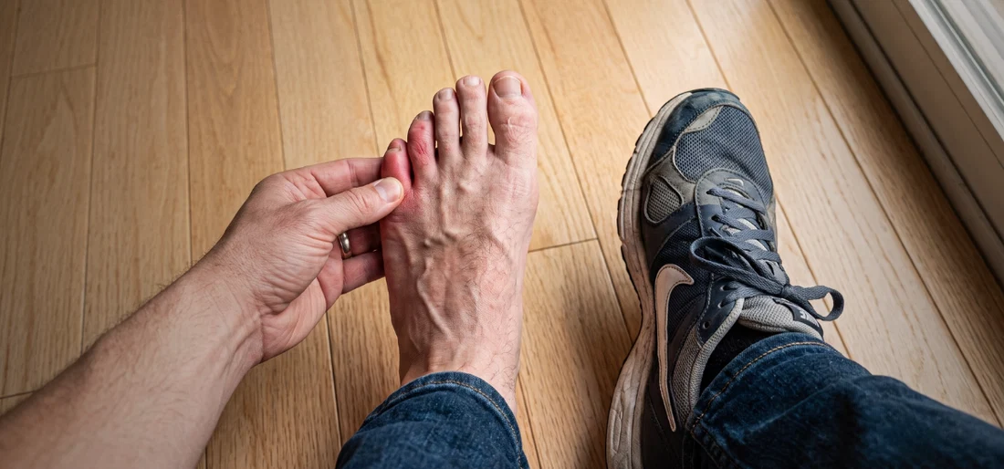 Why Does My Pinky Toe Hurt? Common Causes Explained 2026