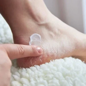 Why Are My Toes Peeling? Causes & Treatments 2026