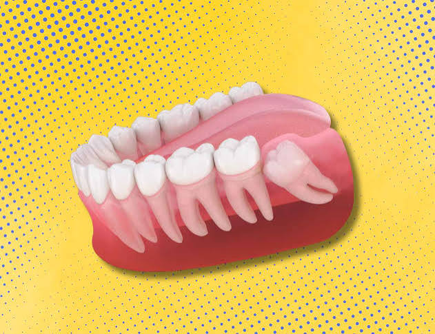 Why Is It Called Wisdom Teeth? The Origin Explained 2026