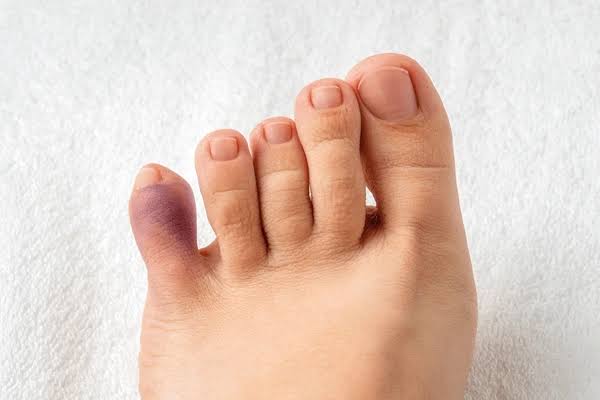 Why Does My Pinky Toe Hurt? Common Causes Explained 2026