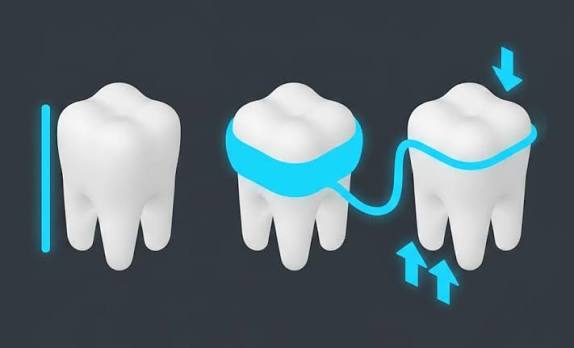 Why Does My Floss Smell Like Poop? Causes & Fixes 2026