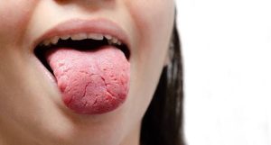 Why Are My Taste Buds Swollen? Causes & Fast Relief 2026