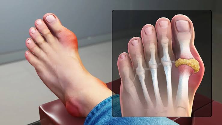 Why Is My Big Toe Hurting? Causes & Relief Tips 2026