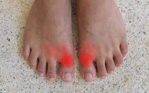 Why Is My Big Toe Hurting? Causes & Relief Tips 2026