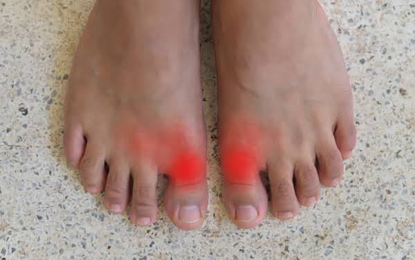 Why Is My Big Toe Hurting? Causes & Relief Tips 2026