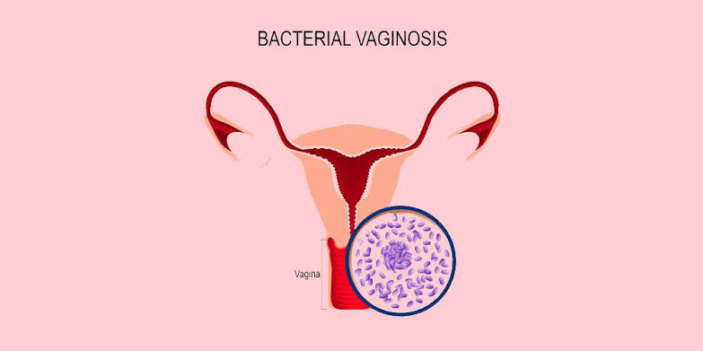 Why Does My Pee Burn After Sex? Causes, Warning Signs, and What To Do 2026