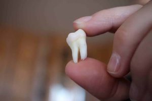 Why Is It Called Wisdom Teeth? The Origin Explained 2026