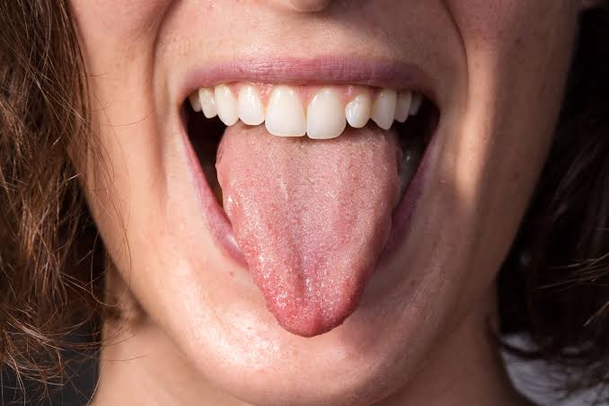 Why Are My Taste Buds Swollen? Causes & Fast Relief 2026