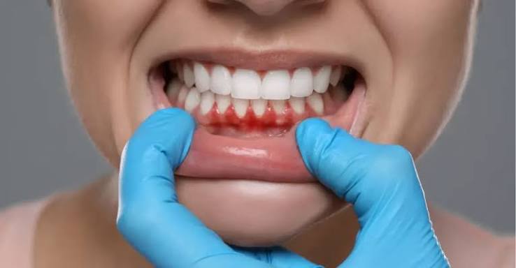 Why Does My Gum Hurt in One Spot in the Back? Causes 2026