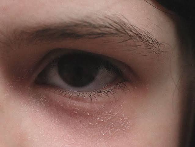 Why Is the Corner of My Eye Itchy? Causes and What to Do 2026