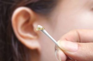 Why Is My Earwax Wet? Causes, Ear Wax Types, and When to Worry 2026
