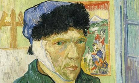 Why Did Vincent Van Gogh Cut Off His Ear? The Real Story 2026
