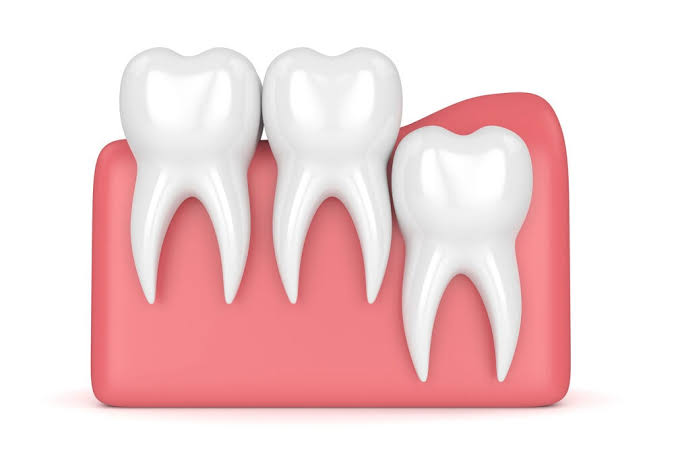 Why Is It Called Wisdom Teeth? The Origin Explained 2026