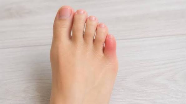 Why Does My Pinky Toe Hurt? Common Causes Explained 2026