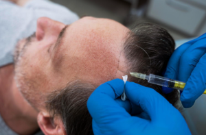 Choosing Hair Restoration in the UAE: What Makes a Transplant Worth Considering?