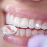 Who Is the Best Cosmetic Dentist  in the UK for Your Smile Goals?